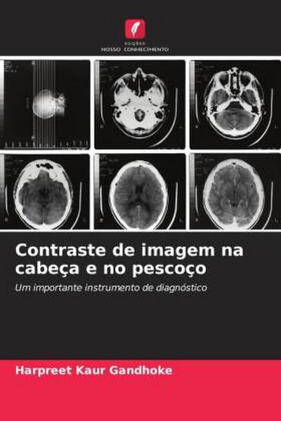 Contraste de imagem na cabeça e no pescoço