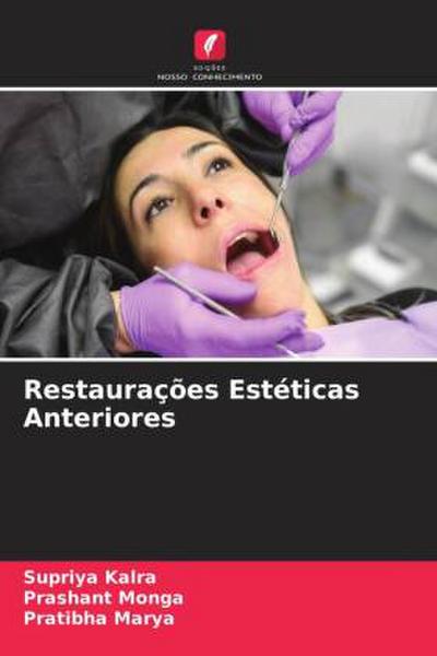 Restaurações Estéticas Anteriores