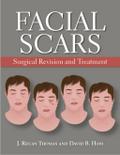 Facial Scars
