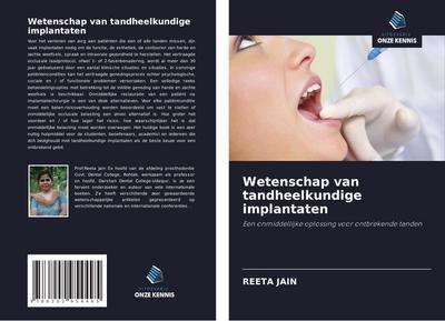 Wetenschap van tandheelkundige implantaten