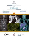 Coleção CBR Volume 9 - Oncologia