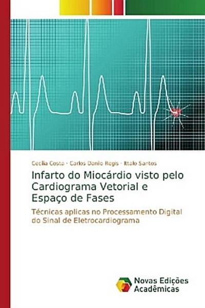 Infarto do Miocárdio visto pelo Cardiograma Vetorial e Espaço de Fases