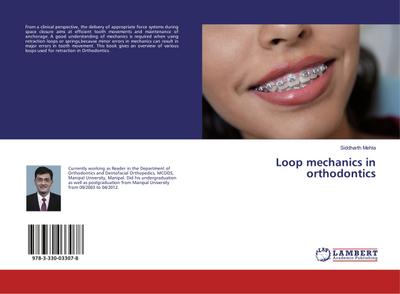 Loop mechanics in orthodontics