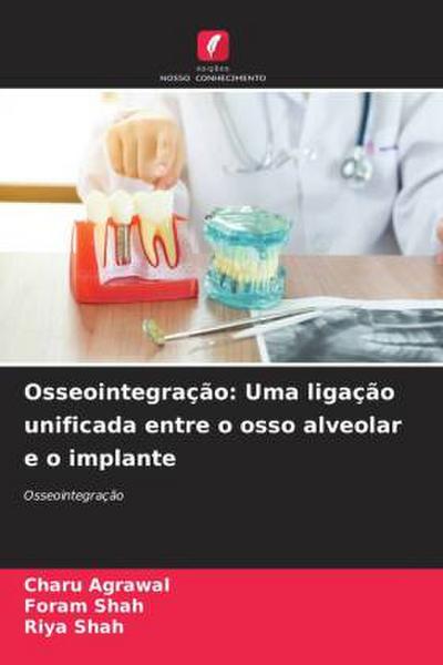 Osseointegração: Uma ligação unificada entre o osso alveolar e o implante