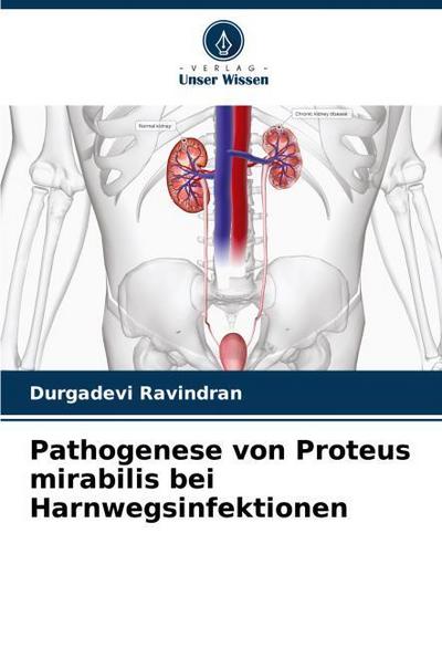 Pathogenese von Proteus mirabilis bei Harnwegsinfektionen
