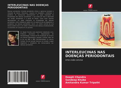 INTERLEUCINAS NAS DOENÇAS PERIODONTAIS