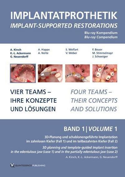 DVD-Kompendium Implantatprothetik 1 - Karl-Ludwig Ackermann
