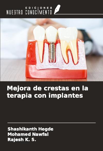Mejora de crestas en la terapia con implantes