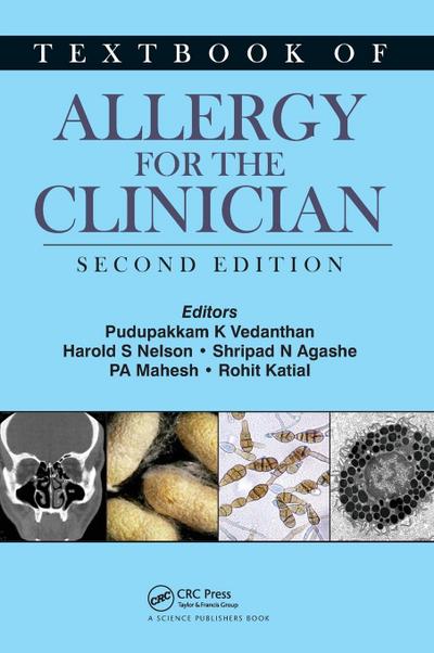 Textbook of Allergy for the Clinician