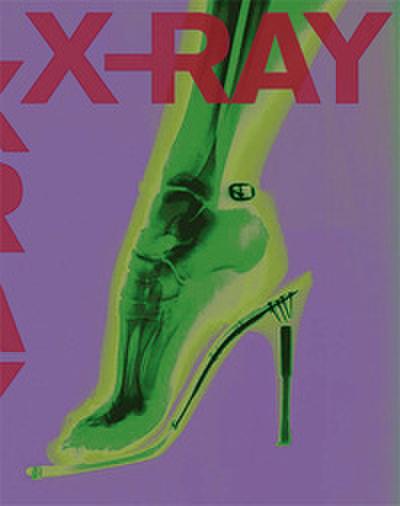 X-RAY