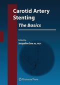 Carotid Artery Stenting