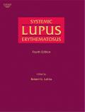 Systemic Lupus Erythematosus