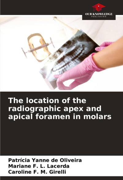 The location of the radiographic apex and apical foramen in molars