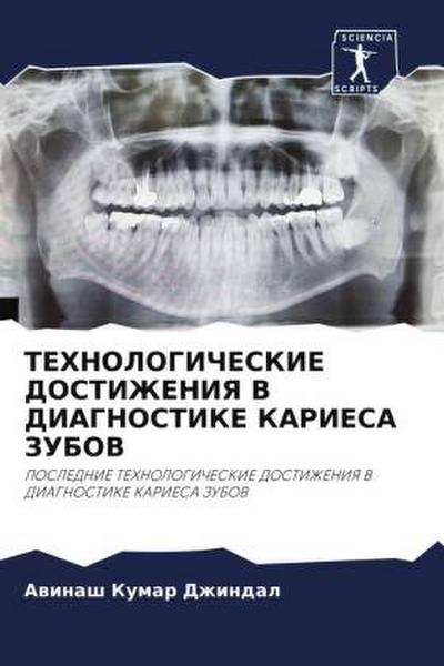 TEHNOLOGIChESKIE DOSTIZhENIYa V DIAGNOSTIKE KARIESA ZUBOV