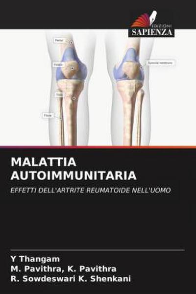MALATTIA AUTOIMMUNITARIA