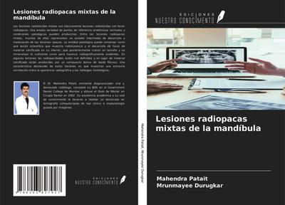 Lesiones radiopacas mixtas de la mandíbula