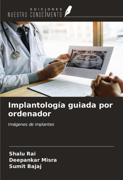 Implantología guiada por ordenador