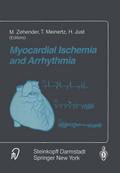 Myocardial Ischemia and Arrhythmia
