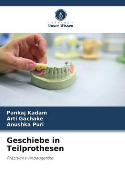 Geschiebe in Teilprothesen