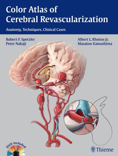 Color Atlas of Cerebral Revascularization