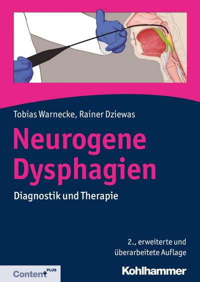 Neurogene Dysphagien: Diagnostik und Therapie