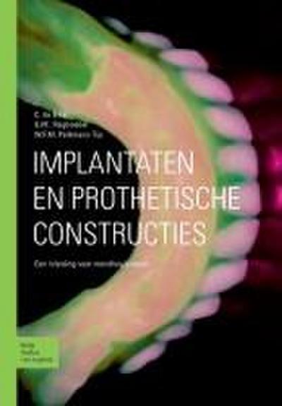Implantaten En Prothetische Constructies
