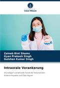 Intraorale Verankerung