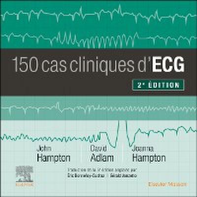 150 cas cliniques d’ECG