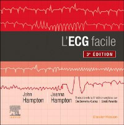 L’’ECG facile