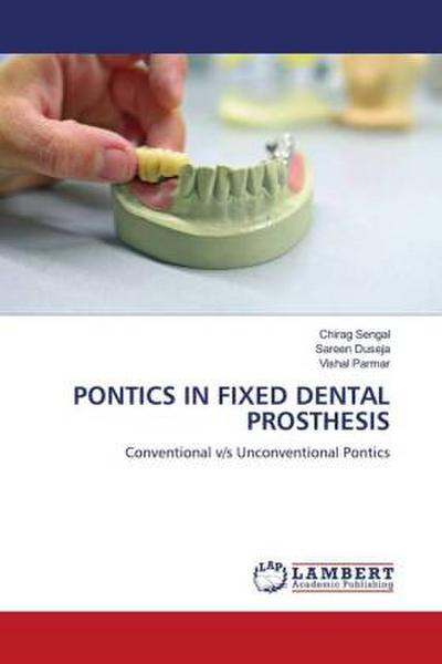 PONTICS IN FIXED DENTAL PROSTHESIS