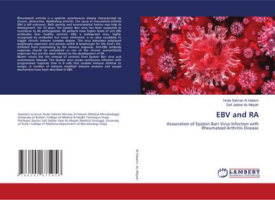 EBV and RA