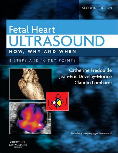 Fetal Heart Ultrasound - E-Book