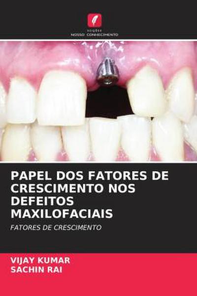 PAPEL DOS FATORES DE CRESCIMENTO NOS DEFEITOS MAXILOFACIAIS