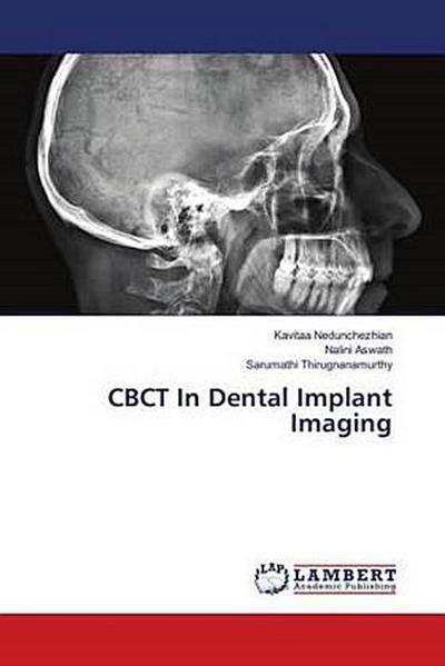 CBCT In Dental Implant Imaging