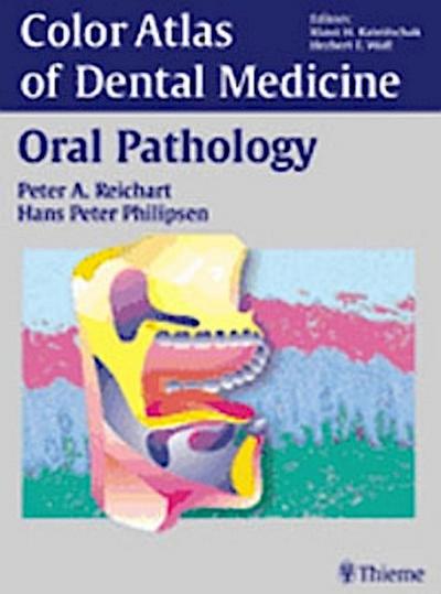 Color Atlas of Dental Medicine Oral Pathology
