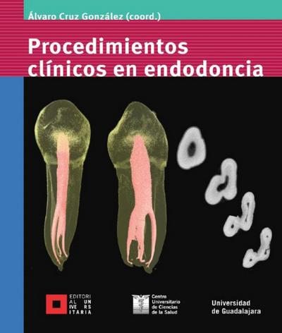 Procedimientos clínicos en endodoncia