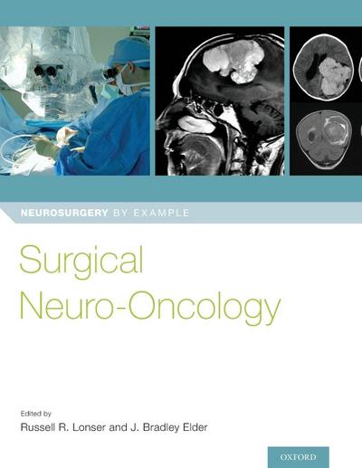 Surgical Neuro-Oncology