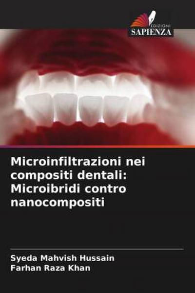 Microinfiltrazioni nei compositi dentali: Microibridi contro nanocompositi