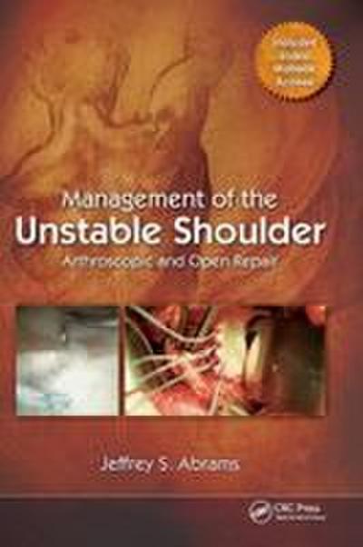 Management of the Unstable Shoulder