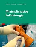 Minimalinvasive Fußchirurgie