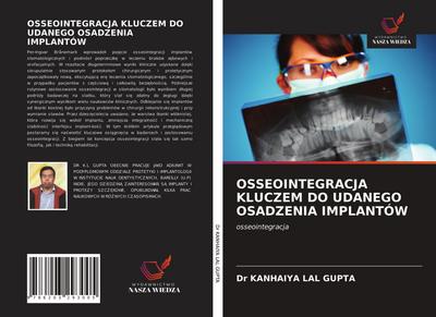 OSSEOINTEGRACJA KLUCZEM DO UDANEGO OSADZENIA IMPLANTÓW