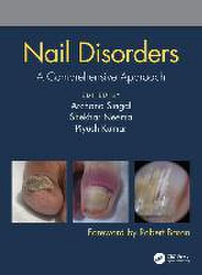 Nail Disorders
