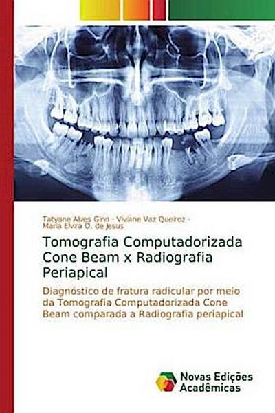 Tomografia Computadorizada Cone Beam x Radiografia Periapical