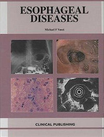 Esophageal Diseases: An Atlas of Investigation and Management