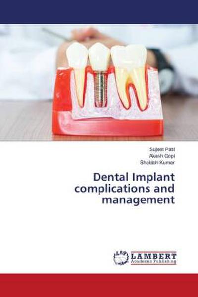 Dental Implant complications and management