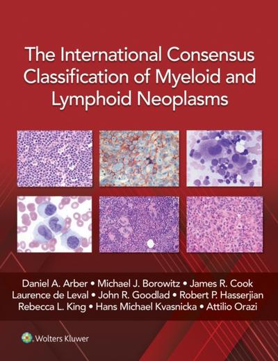 International Consensus Classification of Myeloid and Lymphoid Neoplasms