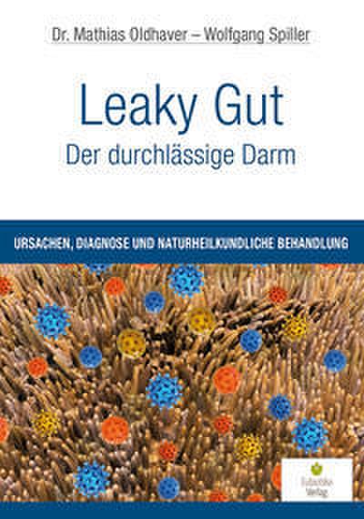 Leaky Gut - Der durchlässige Darm