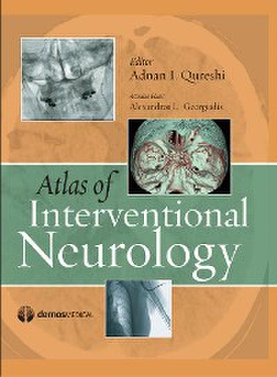 Atlas of Interventional Neurology