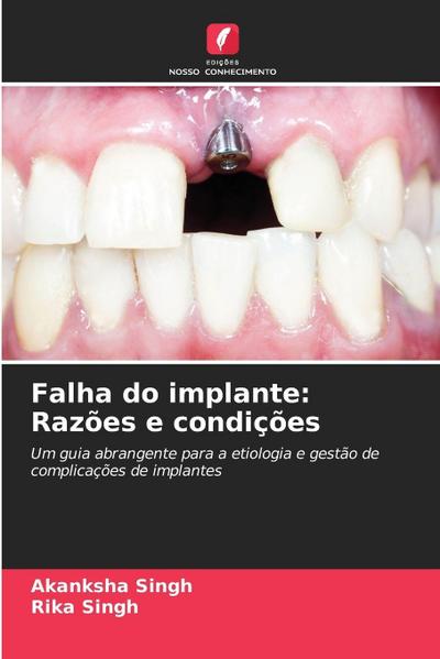 Falha do implante: Razões e condições