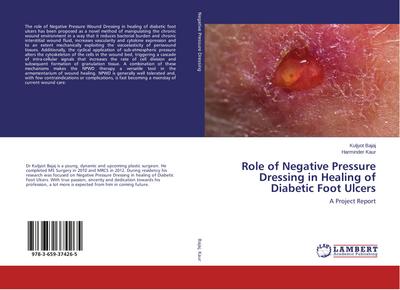 Role of Negative Pressure Dressing in Healing of Diabetic Foot Ulcers